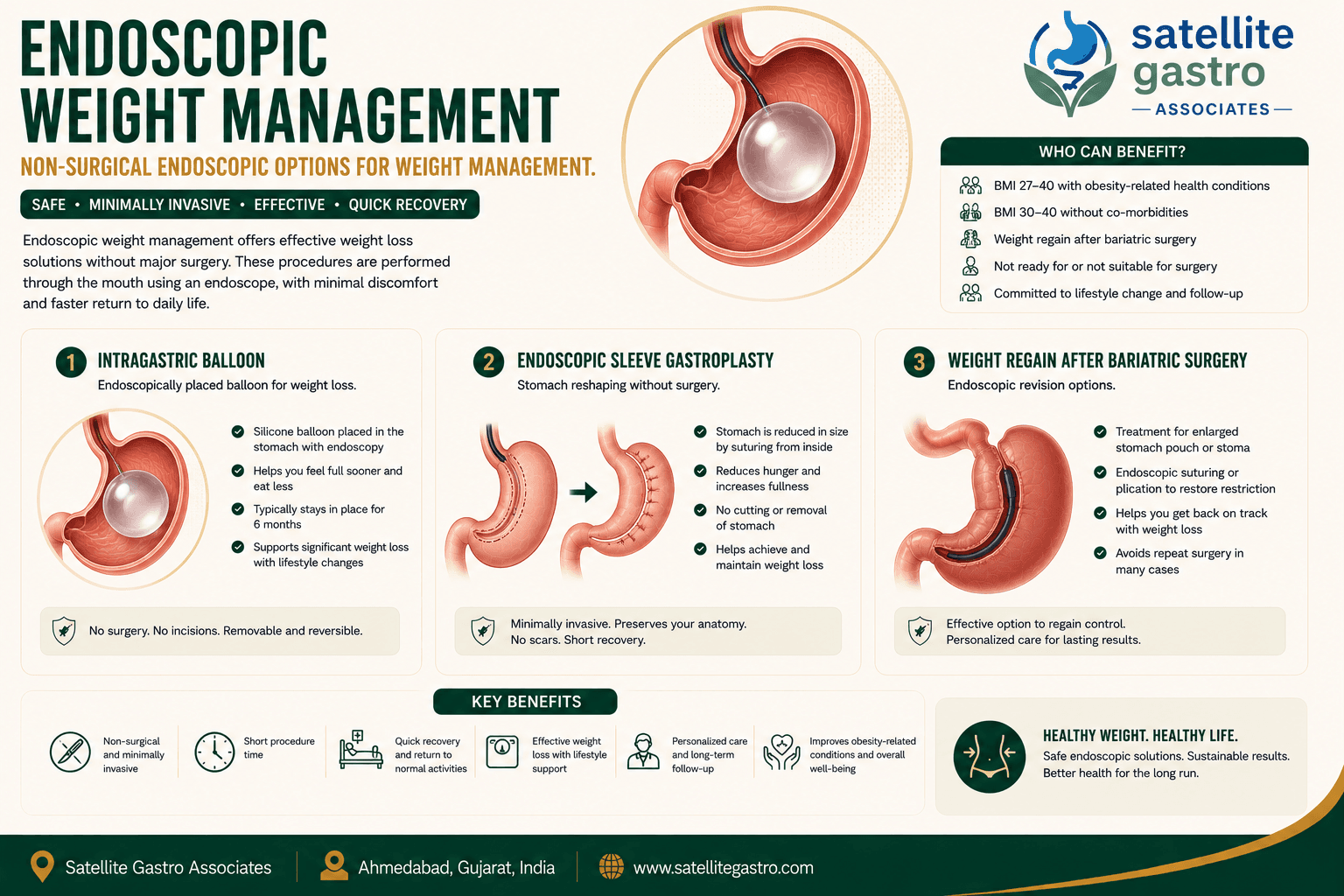 Endoscopic Weight Loss Treatment