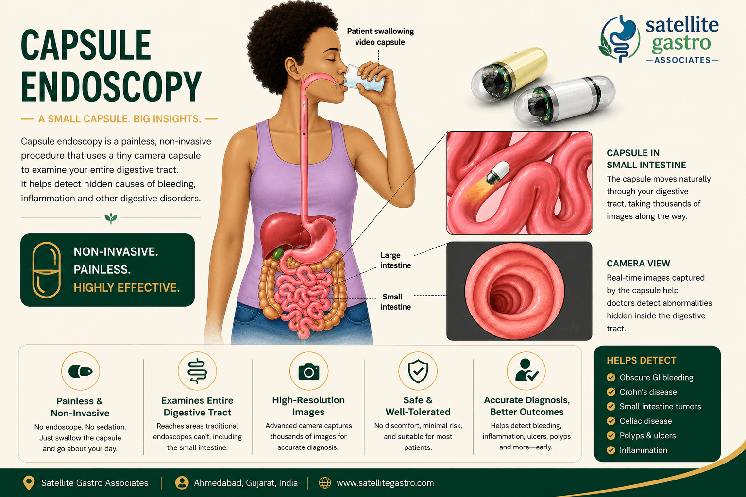 Capsule Endoscopy