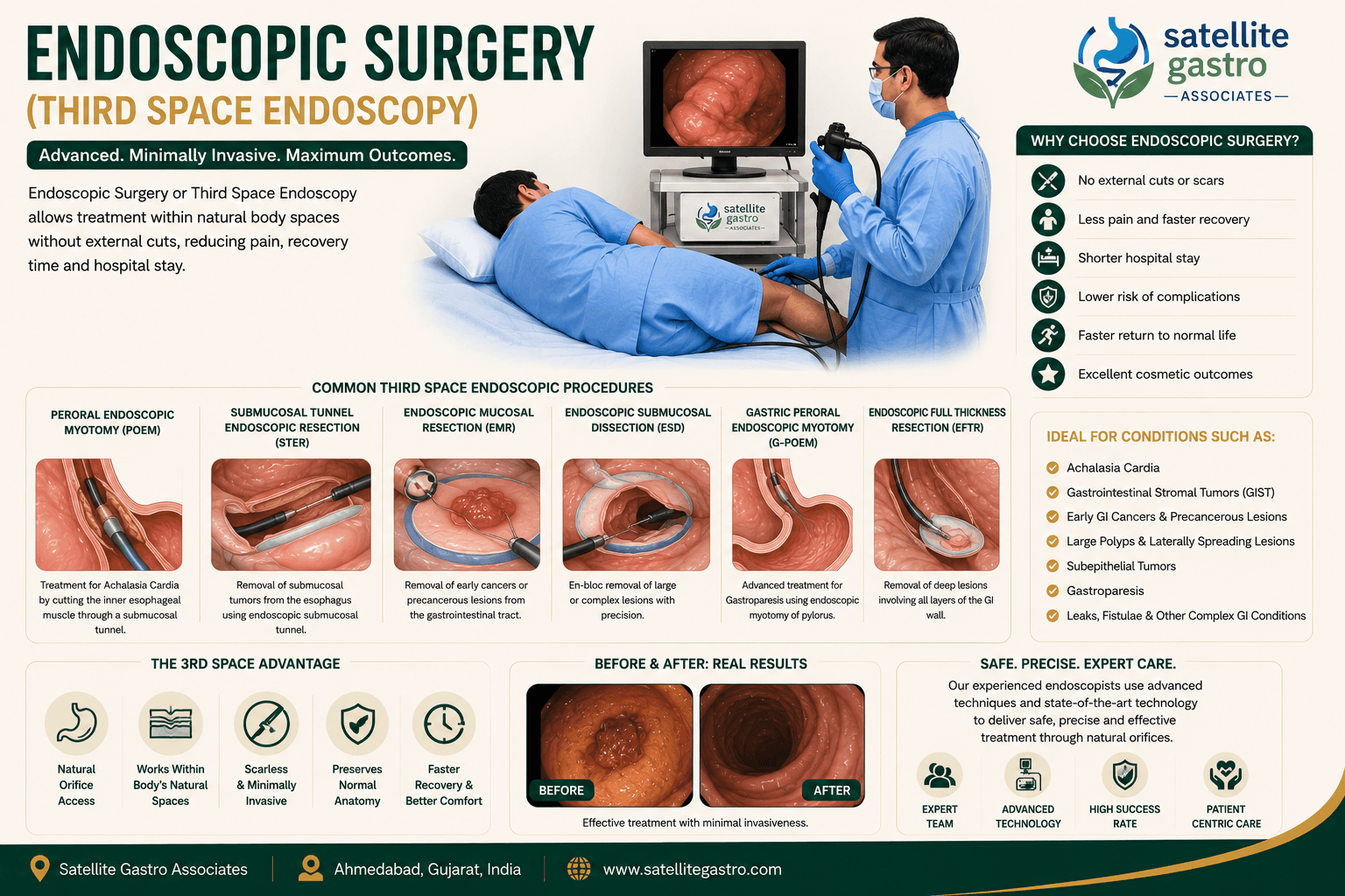 Third Space Endoscopy (ESD, EFTR, STER)